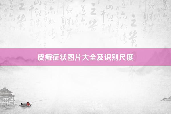 皮癣症状图片大全及识别尺度